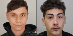 Mimoriadne pátranie po 2 mladíkoch! Mali brutálne zaútočiť na taxikára v Seredi – AKTUALIZOVANÉ